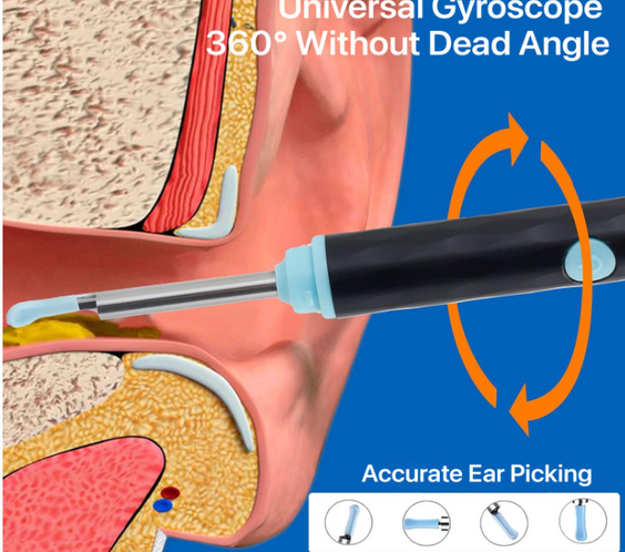 EarView 360° Smart Cleaner Pro