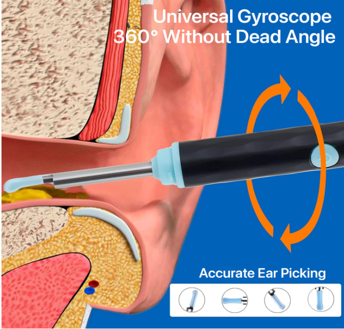 EarView 360° Smart Cleaner Pro